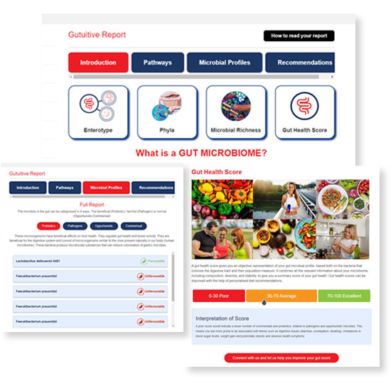 ultimate report for gut health